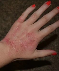 Morris Rigid Collodion Costume Accessories