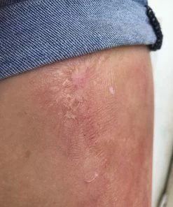 Morris Rigid Collodion Costume Accessories